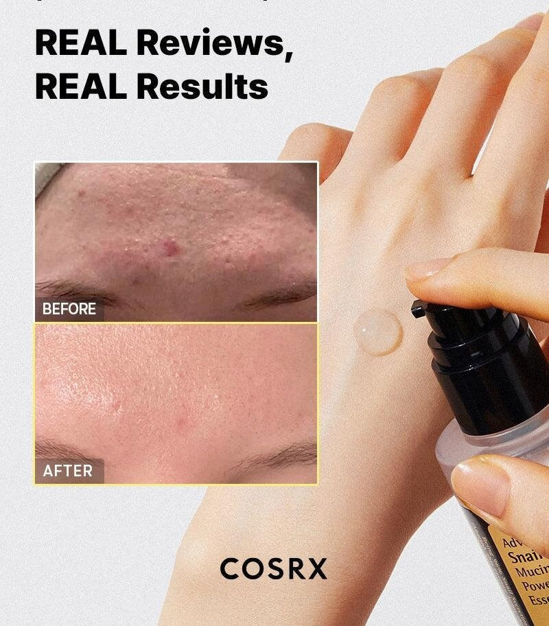 COSRX- Advanced Snail 96 Mucin Power Essence